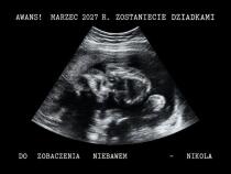 Prezent dla Przyszłej Babci, Dziadka, Prababci, Pradziadka ze zdjęcia USG – obrazek dla dziadków 31611 - miniaturka 2