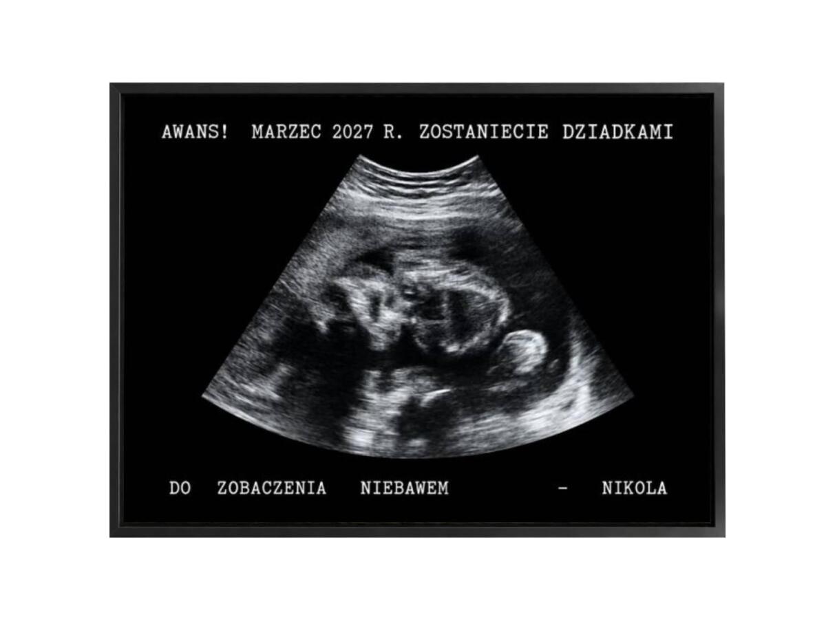 Prezent dla Przyszłej Babci, Dziadka, Prababci, Pradziadka ze zdjęcia USG – obrazek dla dziadków 31611